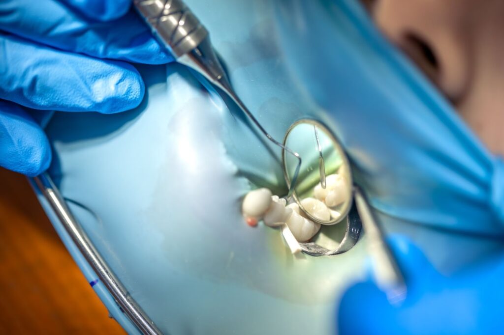 Зъболекар в дентална клиника лекува зъбите на пациент с помощта на кофердам.